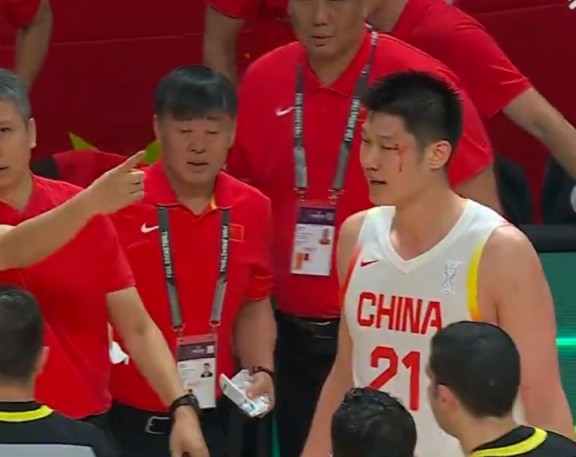 胡金秋眉骨被打开!杨健:这是泰拳啊?周琦:我也被打不过没出血 胡金秋眉骨被打开!杨健:这是泰拳啊?周琦:我也被打不过没出血